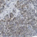 Merck Anti-KCNJ5 antibody produced in rabbit