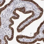 Merck Anti-SLC20A2 antibody produced in rabbit