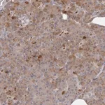 Merck Anti-ANKRD44 antibody produced in rabbit