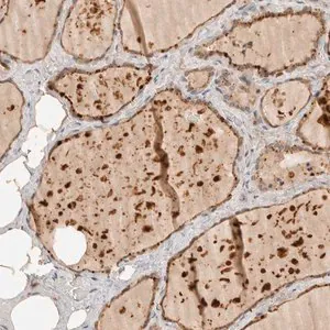 Merck Anti-ITPA antibody produced in rabbit