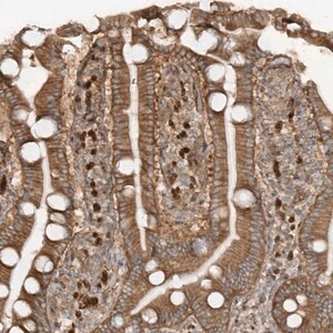 Merck Anti-SDCCAG3 antibody produced in rabbit