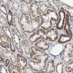 Merck Anti-SLC25A31 antibody produced in rabbit