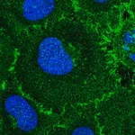 Merck Anti-ROBO1 antibody produced in rabbit