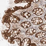 Merck Anti-AK8 antibody produced in rabbit