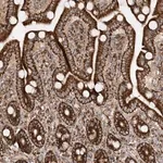 Merck Anti-AARS2 antibody produced in rabbit