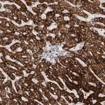 Merck Anti-C17orf99 antibody produced in rabbit
