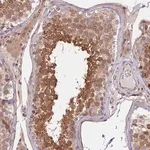 Merck Anti-RIC8A antibody produced in rabbit