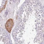 Merck Anti-SERINC3 antibody produced in rabbit