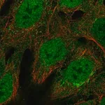Merck Anti-BCL6 antibody produced in rabbit