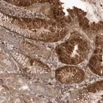 Merck Anti-PEAK1 antibody produced in rabbit
