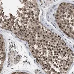 Merck Anti-MCOLN2 antibody produced in rabbit