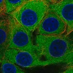 Merck Anti-PFKP antibody produced in rabbit