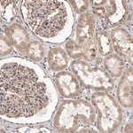 Merck Anti-ALPK1 antibody produced in rabbit
