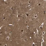 Merck Anti-SRRM3 antibody produced in rabbit