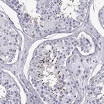 Merck Anti-PGK2 antibody produced in rabbit
