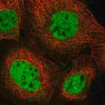 Merck Anti-NCOA6 antibody produced in rabbit