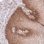 Merck Anti-OTUD4 antibody produced in rabbit