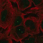 Merck Anti-MCIDAS antibody produced in rabbit
