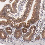 Merck Anti-BAIAP2L2 antibody produced in rabbit