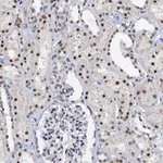 Merck Anti-SNRPD1 antibody produced in rabbit