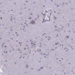 Merck Anti-TMEM206 antibody produced in rabbit