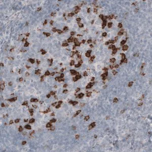 Merck Monoclonal Anti-PDCD1 antibody produced in mouse