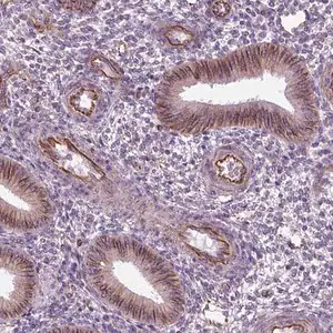 Merck Anti-ACER3 antibody produced in rabbit