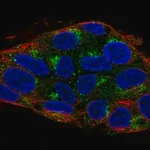 Merck Anti-UBIAD1 antibody produced in rabbit