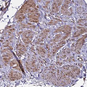 Merck Anti-MOCS1 antibody produced in rabbit