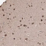 Merck Anti-TENM1 antibody produced in rabbit