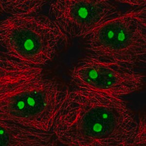 Merck Anti-KNOP1 antibody produced in rabbit