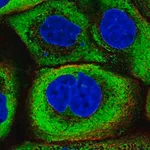 Merck Anti-YBX1 antibody produced in rabbit