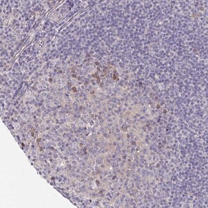 Merck Anti-LTK antibody produced in rabbit