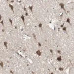 Merck Anti-PFDN1 antibody produced in rabbit