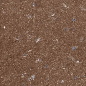 Merck Anti-LRSAM1 antibody produced in rabbit