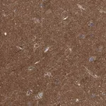 Merck Anti-LRSAM1 antibody produced in rabbit