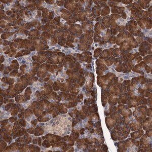 Merck Anti-RGS11 antibody produced in rabbit
