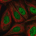 Merck Anti-AKIP1 antibody produced in rabbit