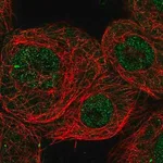 Merck Anti-CHD8 antibody produced in rabbit