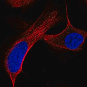 Merck Anti-ATM antibody produced in rabbit