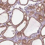 Merck Anti-PRAG1 antibody produced in rabbit