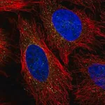 Merck Anti-LPL antibody produced in rabbit