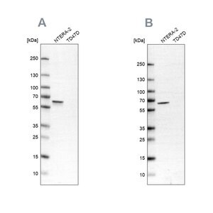 Merck Anti-UPF3B antibody produced in rabbit