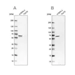 Merck Anti-UPF3B antibody produced in rabbit