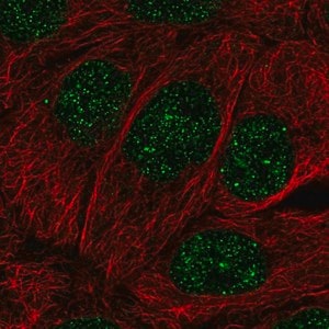 Merck Anti-MBD2 antibody produced in rabbit