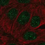 Merck Anti-MBD2 antibody produced in rabbit