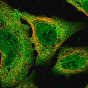 Merck Anti-SLC8A1 antibody produced in rabbit