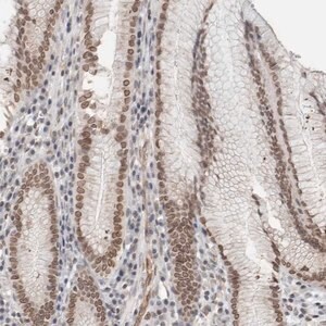 Merck Anti-RBMX2 antibody produced in rabbit