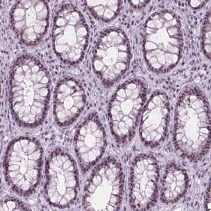 Merck Anti-NOL7 antibody produced in rabbit