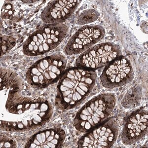 Merck Anti-PARM1 antibody produced in rabbit